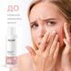 Отшелушивающий тонер для лица RECARE Exfoliating Face Toner, 150 мл REC02 фото 2