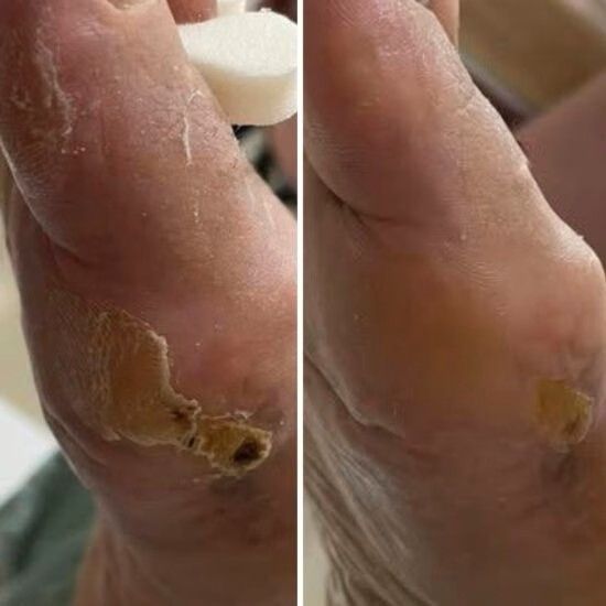 Крем від тріщин для рук та стоп Resultum Anti Crack Cream Jojoba з жожоба, 50 мл CR02 фото