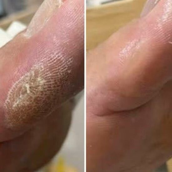 Крем від тріщин для рук та стоп Resultum Anti Crack Cream Jojoba з жожоба, 50 мл CR02 фото