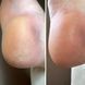 Крем від тріщин для рук та стоп Resultum Anti Crack Cream Jojoba з жожоба, 50 мл CR02 фото 5