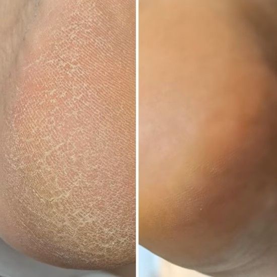 Регенеруючий крем від тріщин з обліпихою та лемонграсом Resultum Regenerix Cream, 25 мл CR03 фото