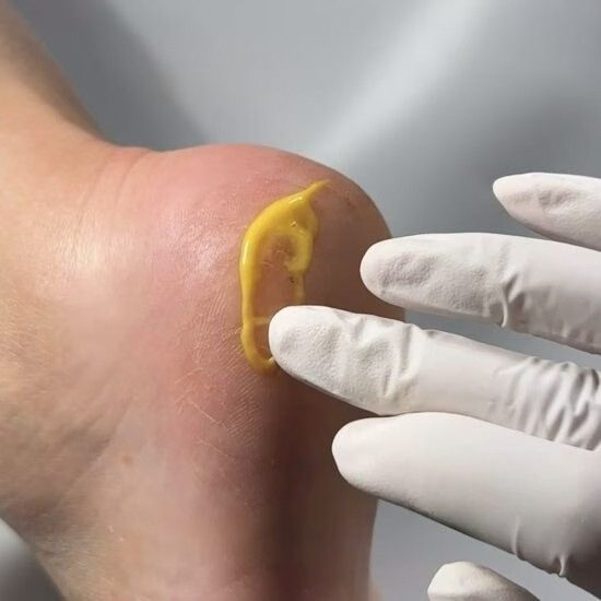 Регенеруючий крем від тріщин з обліпихою та лемонграсом Resultum Regenerix Cream, 50 мл CR04 фото